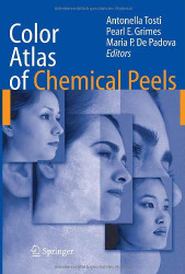 Color Atlas Of Chemical Peels