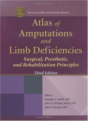 Atlas Of Amputations And Limb Deficiencies