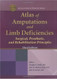Atlas Of Amputations And Limb Deficiencies