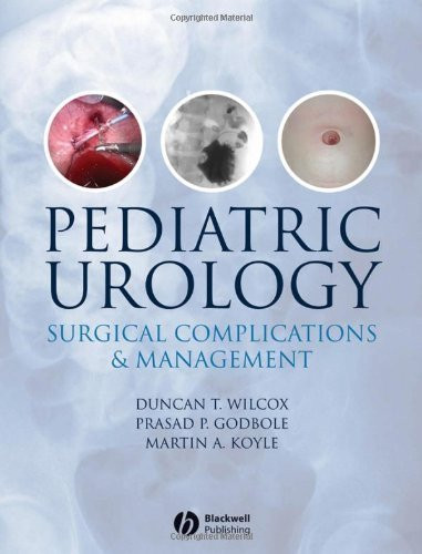 Pediatric Urology Surgical Complications And Management