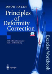 Principles Of Deformity Correction