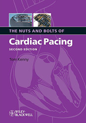 Nuts And Bolts Of Cardiac Pacing