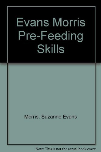 Pre-Feeding Skills