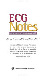 Ecg Notes Interpretation and Management Guide
