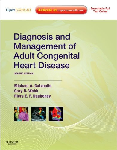 Diagnosis And Management Of Adult Congenital Heart Disease
