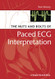 Nuts And Bolts Of Paced Ecg Interpretation