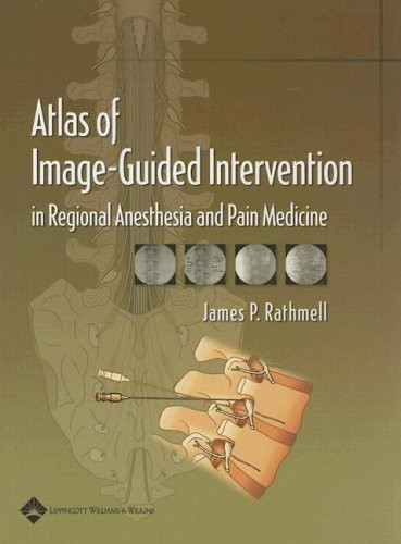 Atlas Of Image-Guided Intervention In Regional Anesthesia & Pain Medicine