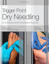 Trigger Point Dry Needling