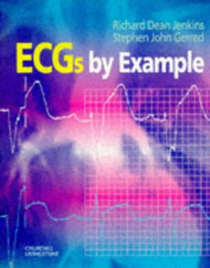 Ecgs By Example