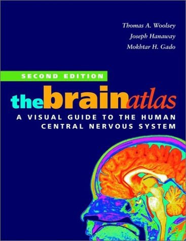 Brain Atlas