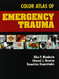 Color Atlas Of Emergency Trauma