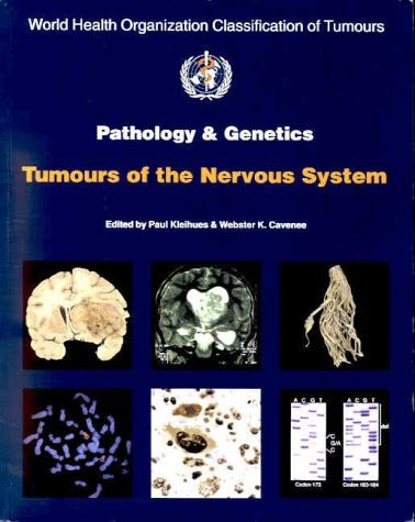 World Health Organization Classification of Tumours