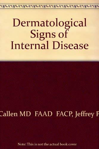 Dermatological Signs Of Internal Disease