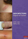 Skin Infections