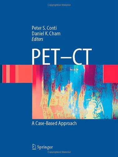 Pet-Ct