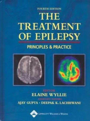 Treatment Of Epilepsy