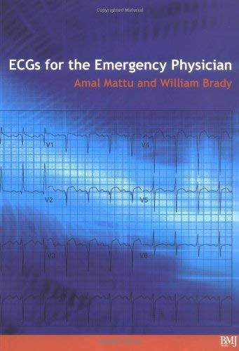 Ecg's For The Emergency Physician 1