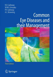 Common Eye Diseases and Their Management