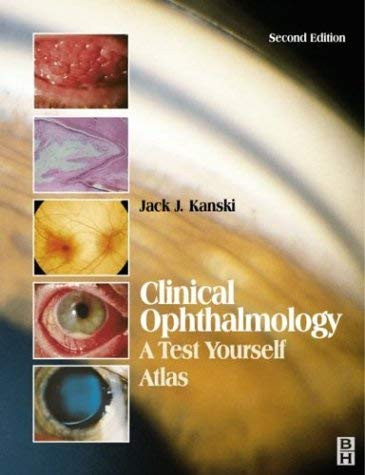 Test Yourself Atlas in Ophthalmology