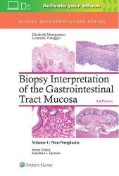 Biopsy Interpretation Of The Gastrointestinal Tract Mucosa Volume 1