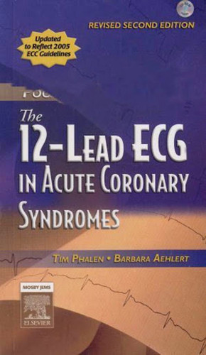 12-Lead Ecg In Acute Coronary Syndromes