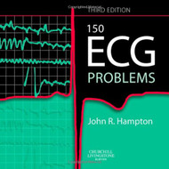 150 ECG Cases