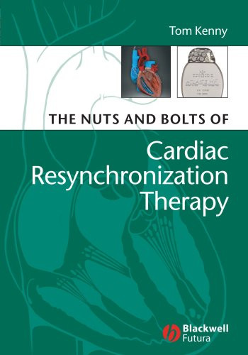 Nuts And Bolts Of Cardiac Resynchronization Therapy