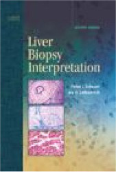 Liver Biopsy Interpretation