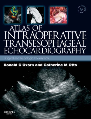 Atlas of Intraoperative Transesophageal  Echocardiography