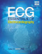 ECG