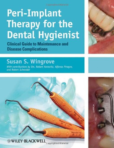 Peri-Implant Therapy For The Dental Hygienist