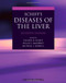 Schiff's Diseases of the Liver