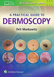 Practical Guide to Dermoscopy