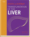 Transplantation of the Liver