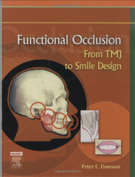 Functional Occlusion