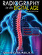 Radiography in the Digital Age