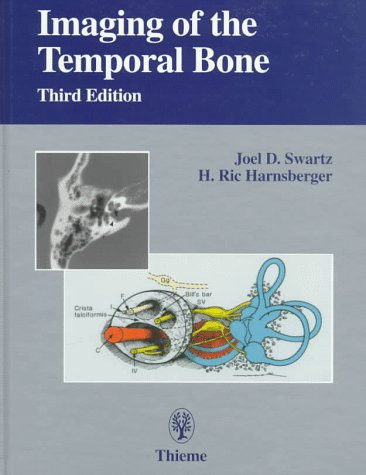 Imaging of the Temporal Bone