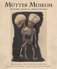 Mutter Museum Historic Medical Photographs