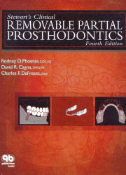 Stewart's Clinical Removable Partial Prosthodontics