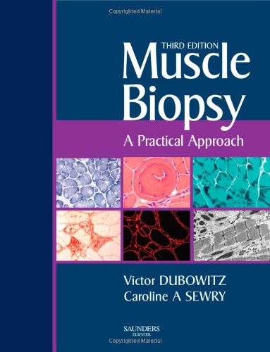 Muscle Biopsy