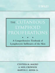 Cutaneous Lymphoid Proliferations