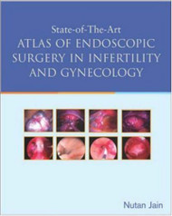 State of the Art Atlas of Endoscopic Surgery In Infertility and Gynecology