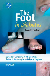 Foot In Diabetes