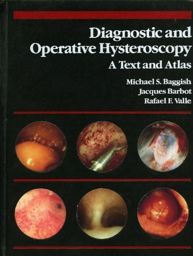 Diagnostic and Operative Hysteroscopy