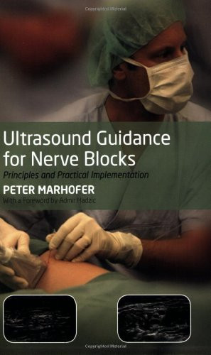 Ultrasound Guidance for Nerve Blocks