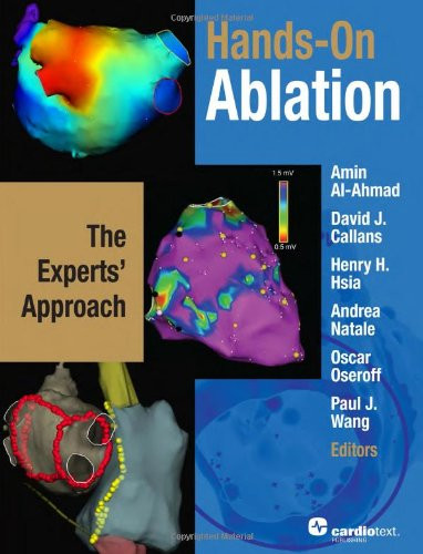 Hands-On Ablation