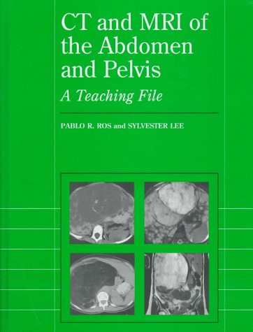 Ct and Mri of the Abdomen and Pelvis