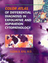 Color Atlas of Differential Diagnosis In Exfoliative and Aspiration