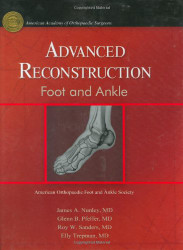 Advanced Reconstruction Foot & Ankle