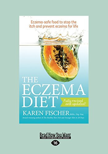 Eczema Diet Eczema-Safe Food To Stop